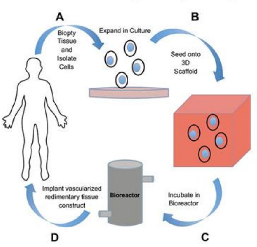 Tissue Engineering Animation The basic tissue engineering paradigm figure 1: basic