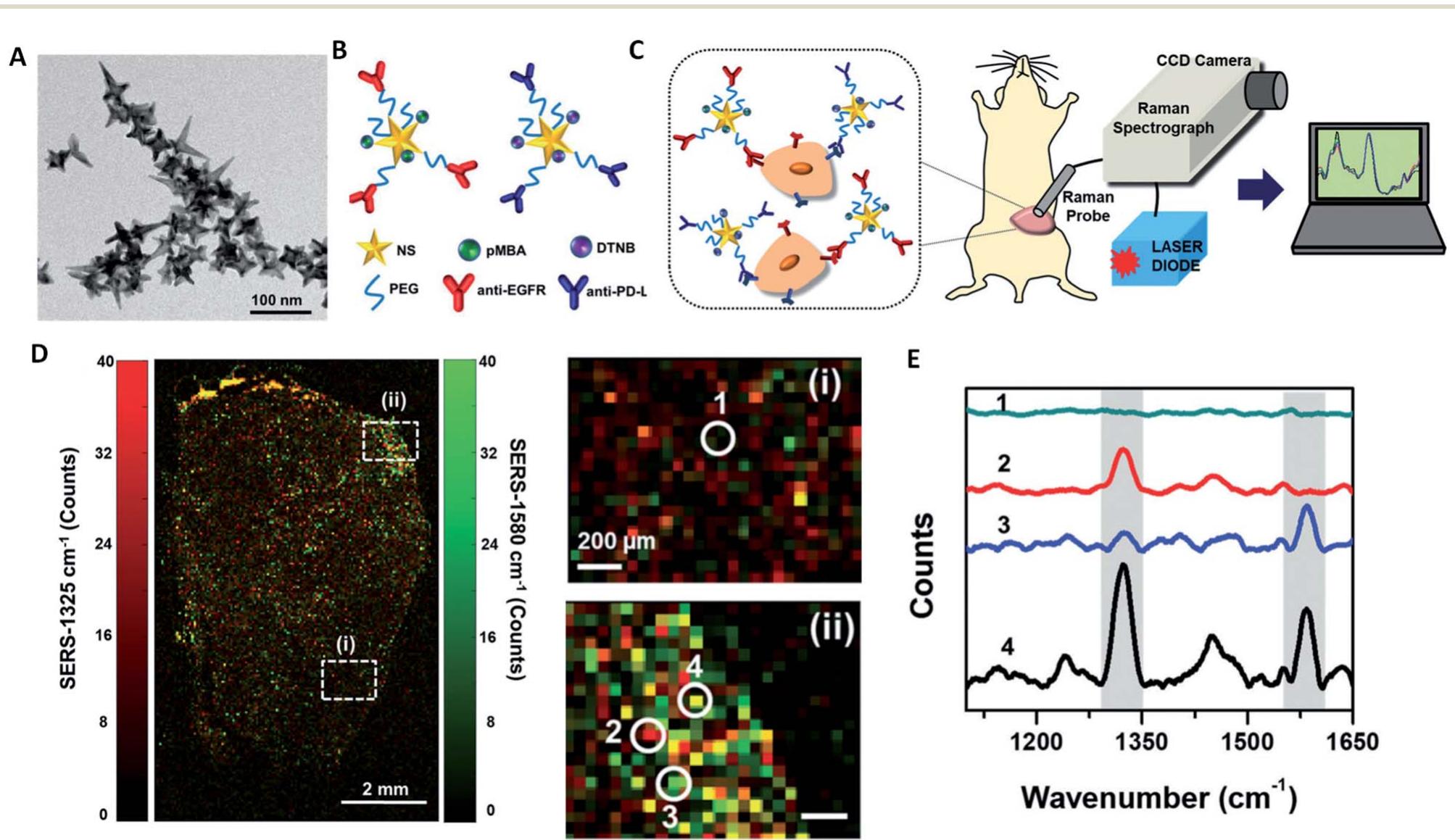 Dark-field microscopy images of normal and two different