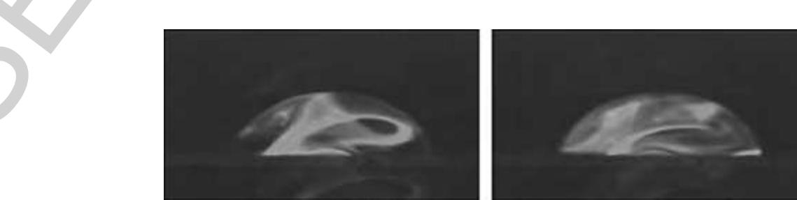 09 Figure 40 = Internal streaming is induced within an approximately 50-nI droplet, hit by SAW. The internal mixing process is  ~ visualized by a fluorescent dye placed on the surface of the chip, which is dissolved by the SAW agitation. (Source: Wixforth A, Strobl C, Gauer C, Toegl A, Scriba J, von Guttenberg Z 2004 Acoustic manipulation of small droplets. Anal. Bioanal. Chem. 379, 982-91. With kind permission of Springer Science and Business Media.) 