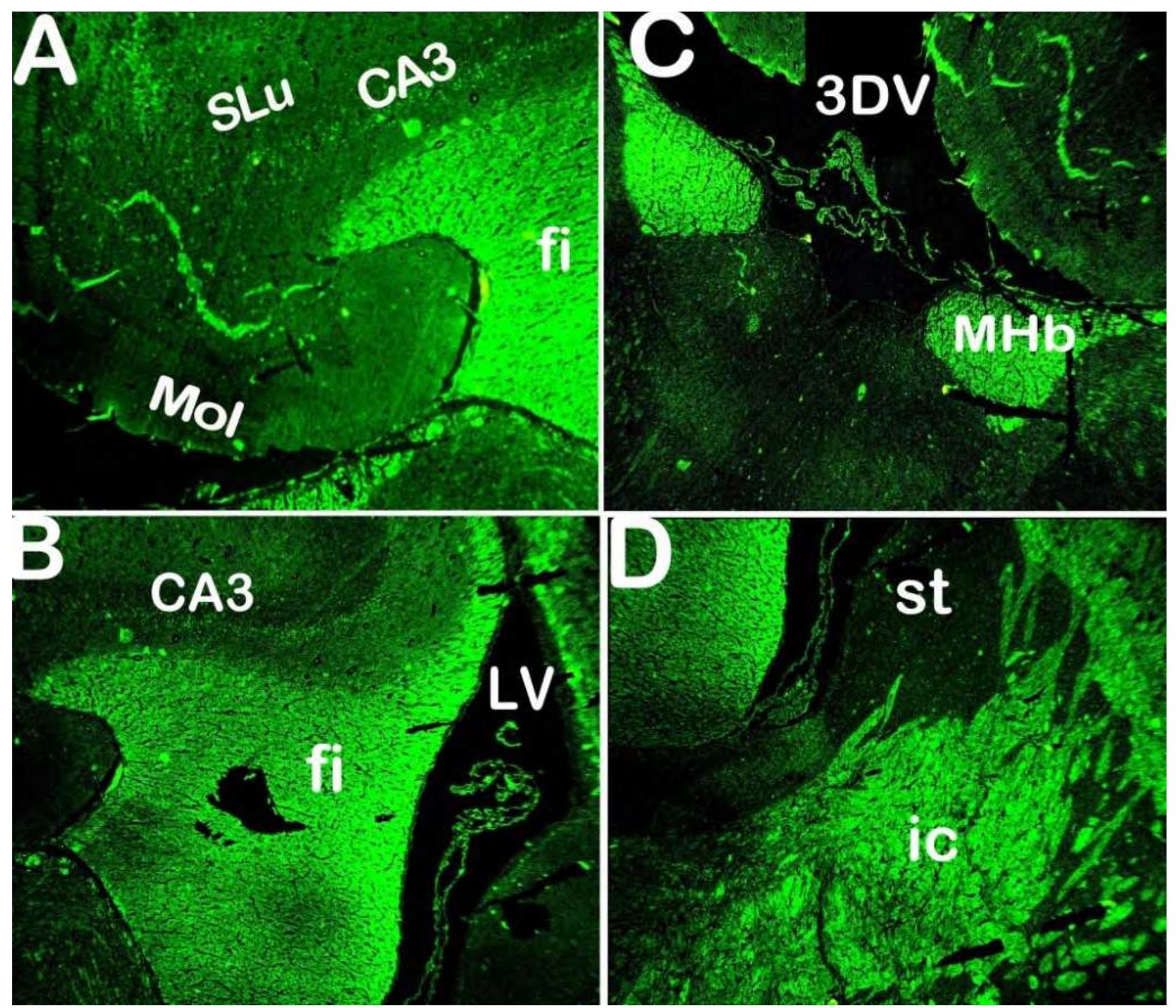 Figure 6 - Localization profile of Cathepsin L in the brain