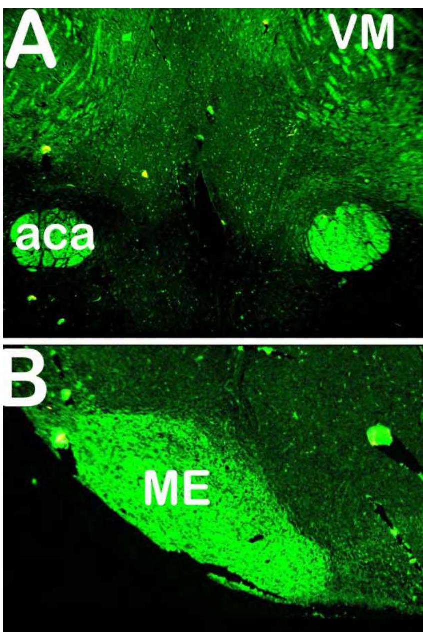 Figure 6 - Localization profile of Cathepsin L in the brain
