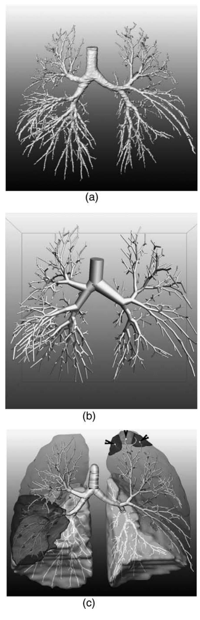 (PDF) A Digital Reference Model of the Human Bronchial Tree
