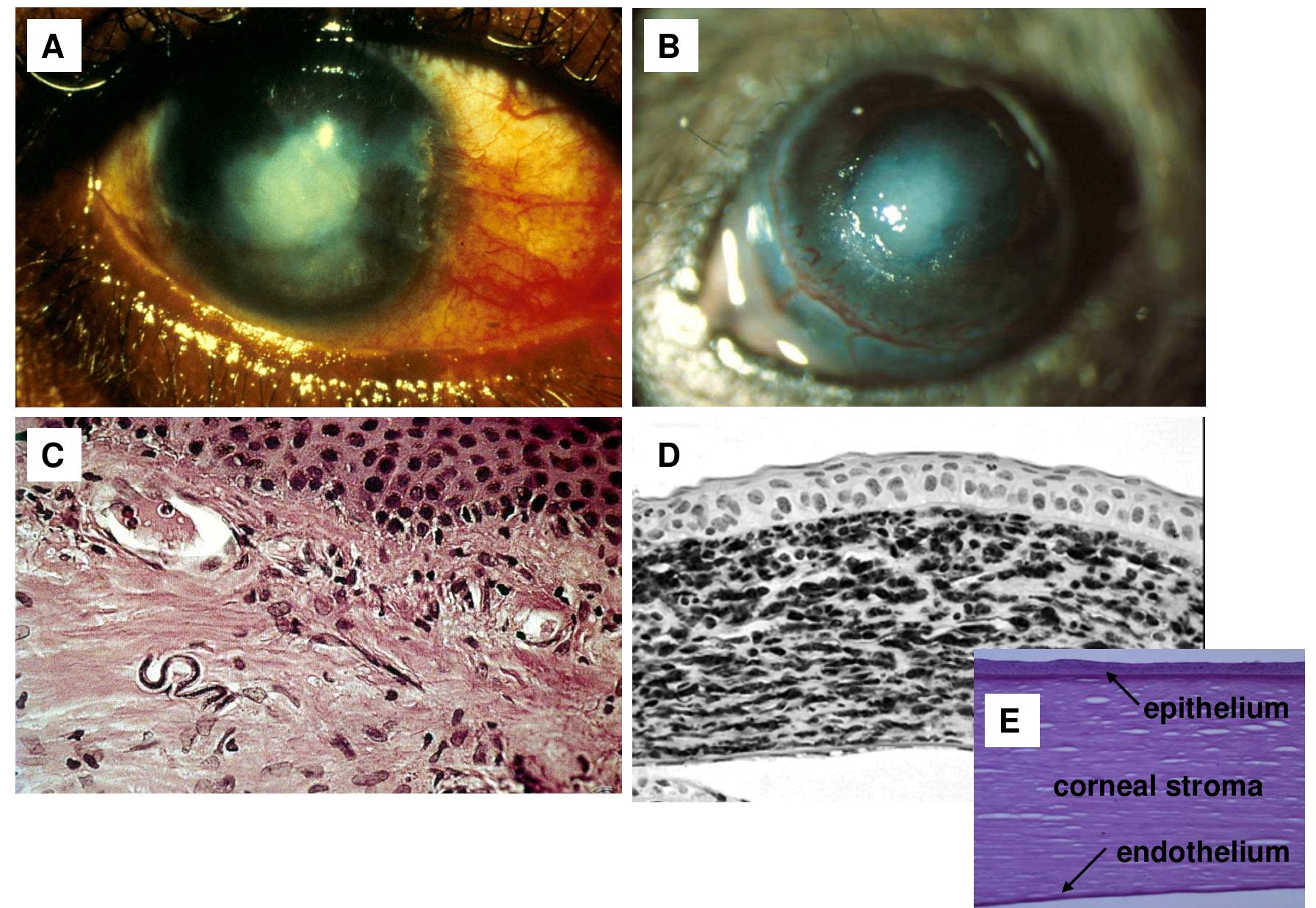 Mouse model of o. volvulus keratitis. injection of o.