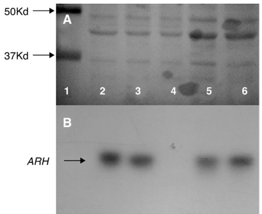 Western blotting of arh protein in cultured fibroblasts and