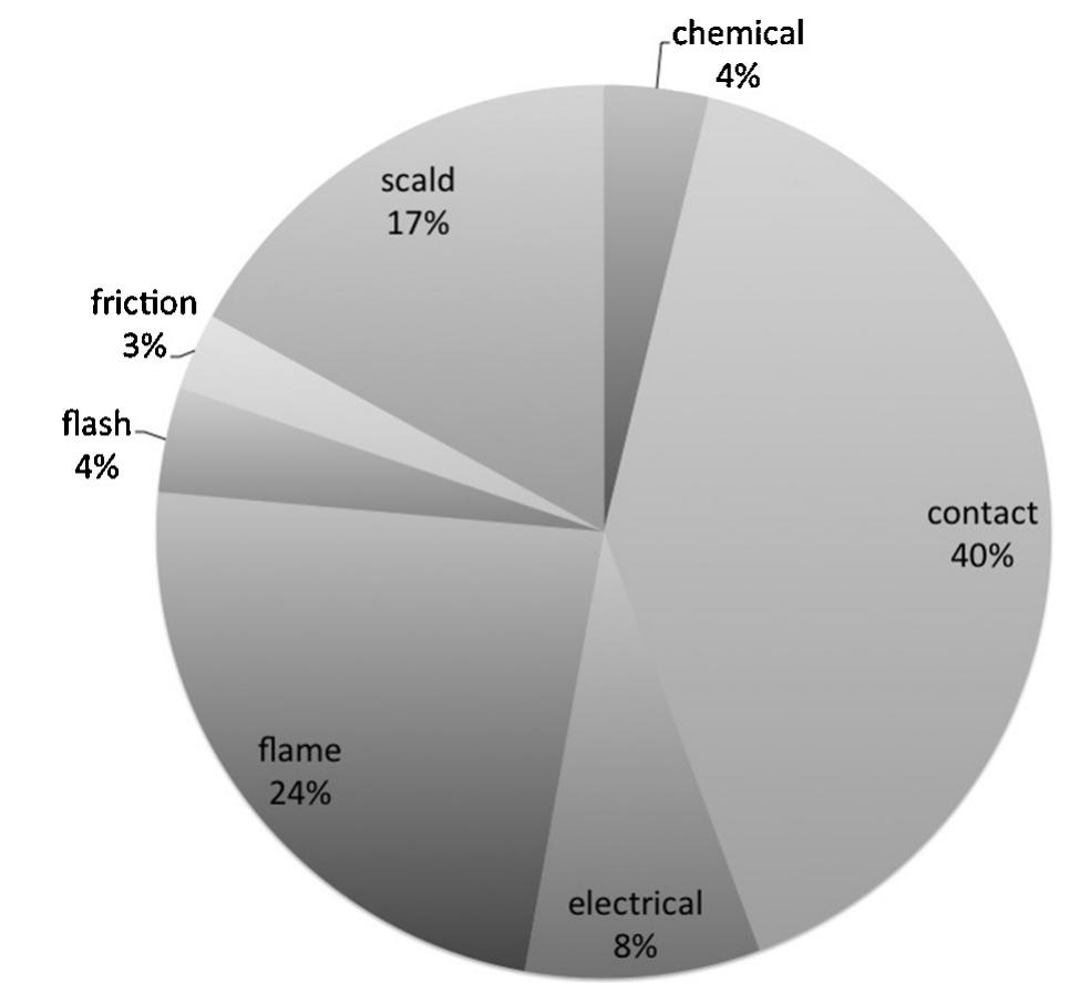 - chart demonstrating the cause of hand burns.