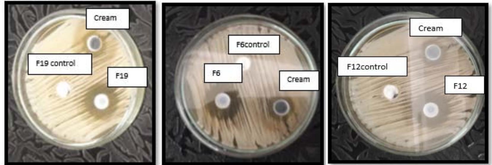 (PDF) FORMULATION AND OPTIMIZATION OF TERBINAFINE HCl SOLID LIPID ...
