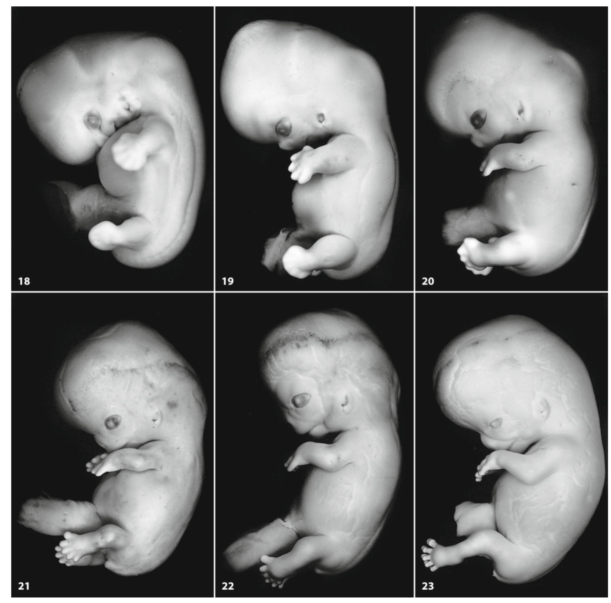 Embryological Rotation 2 (continued) shiota et al. 2007; fig. 1.3). selective