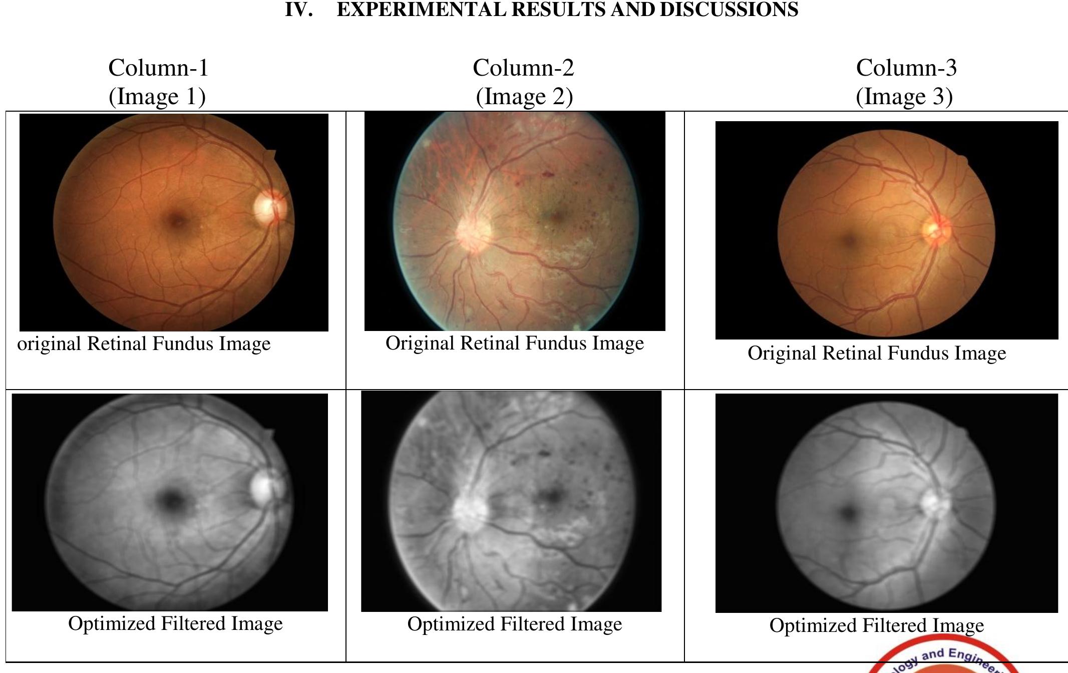 Figure 3 - An Effective Segmentation of Retinal Blood