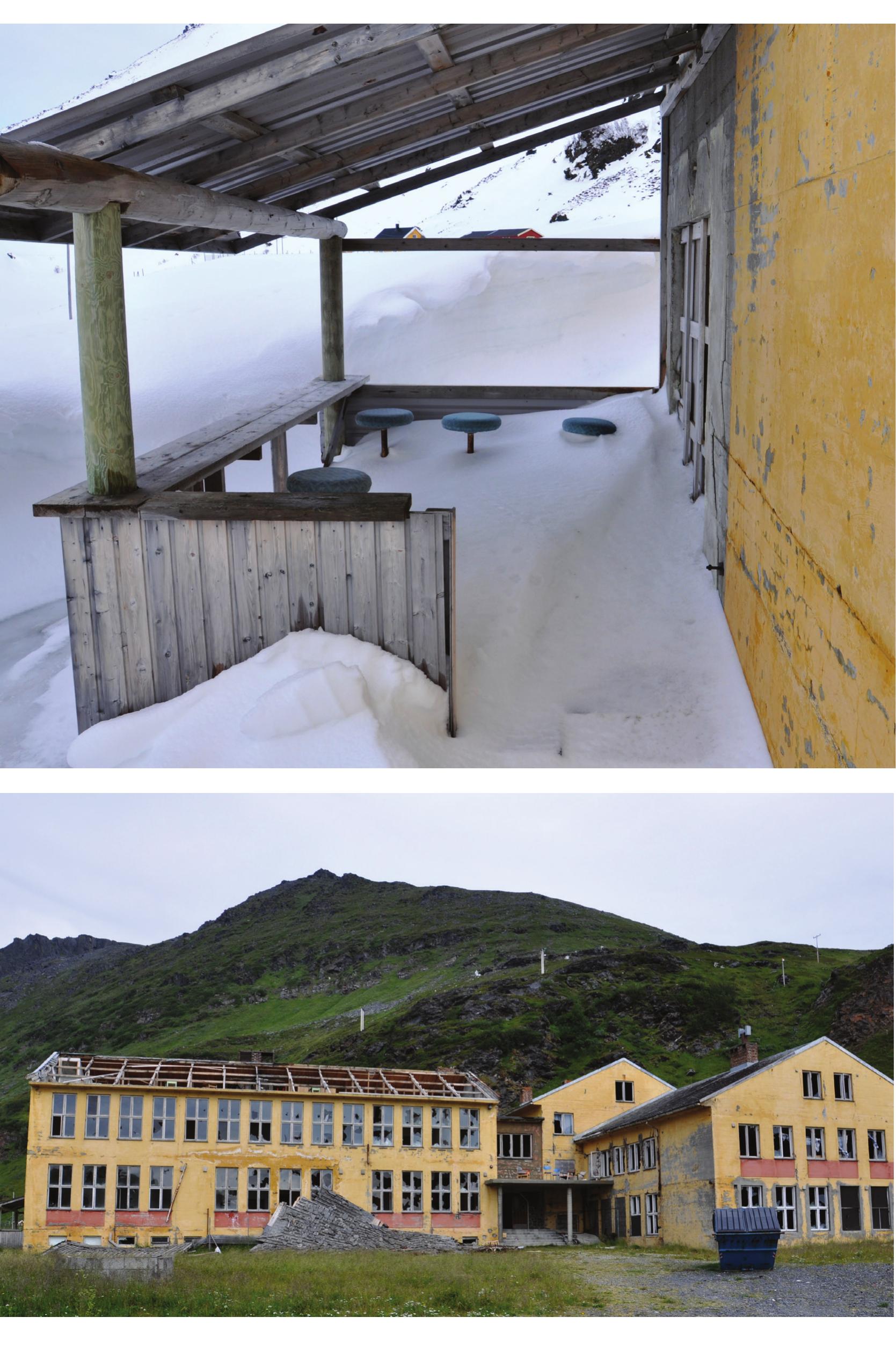 Saraton bilan kasallangan qizlarning eshaklarining yalangoch fotosuratlari