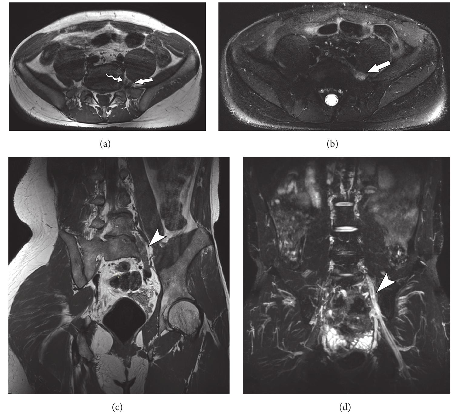 34-year-old male with history of left hip pain with