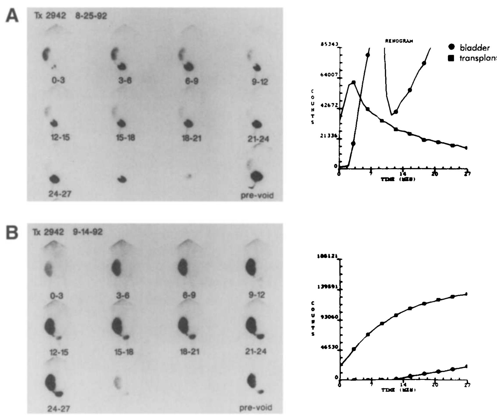 Scintigrams and time-activity curves of a 45-year-old woman,
