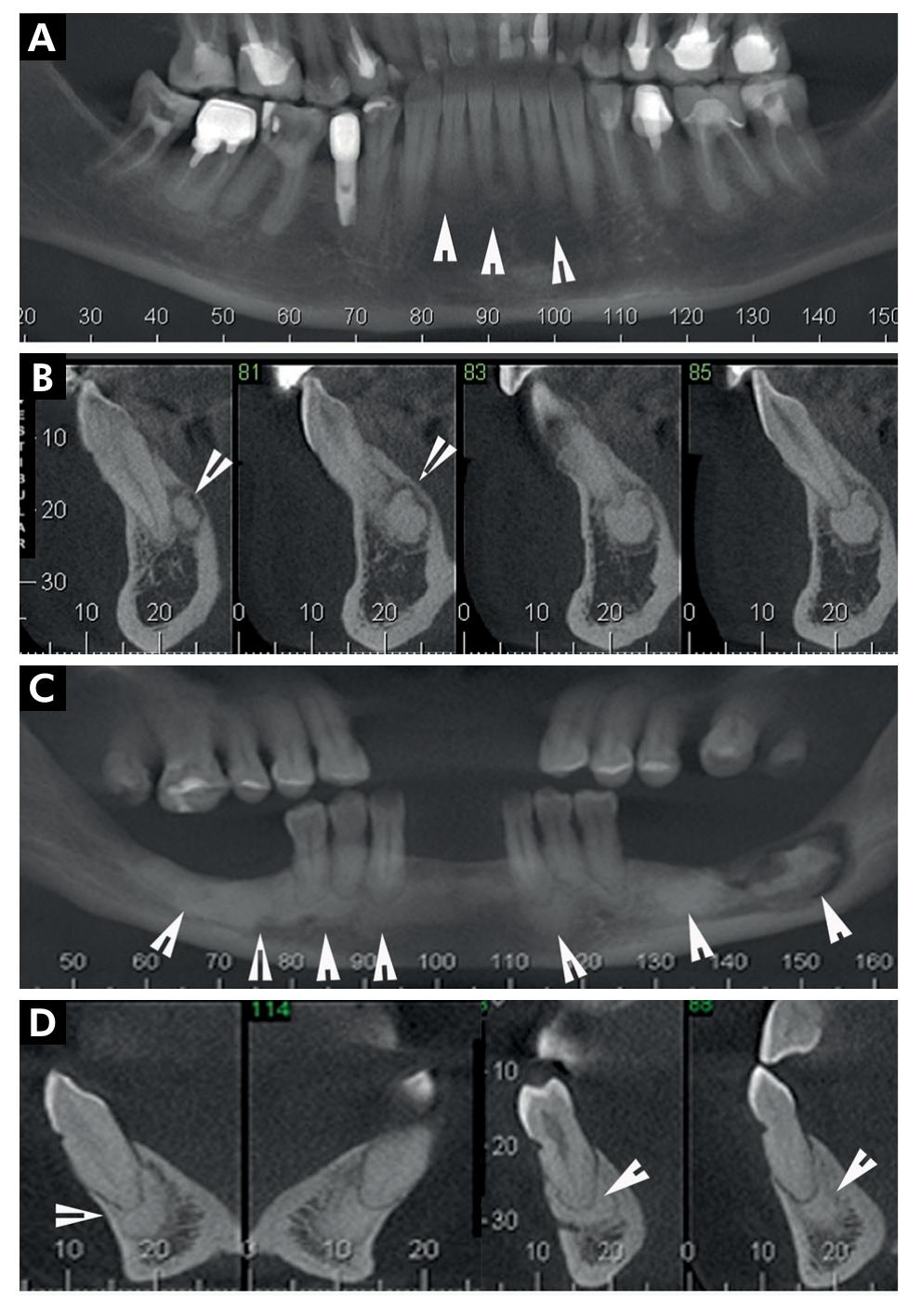 Figure 2 - from Differential diagnosis and clinical