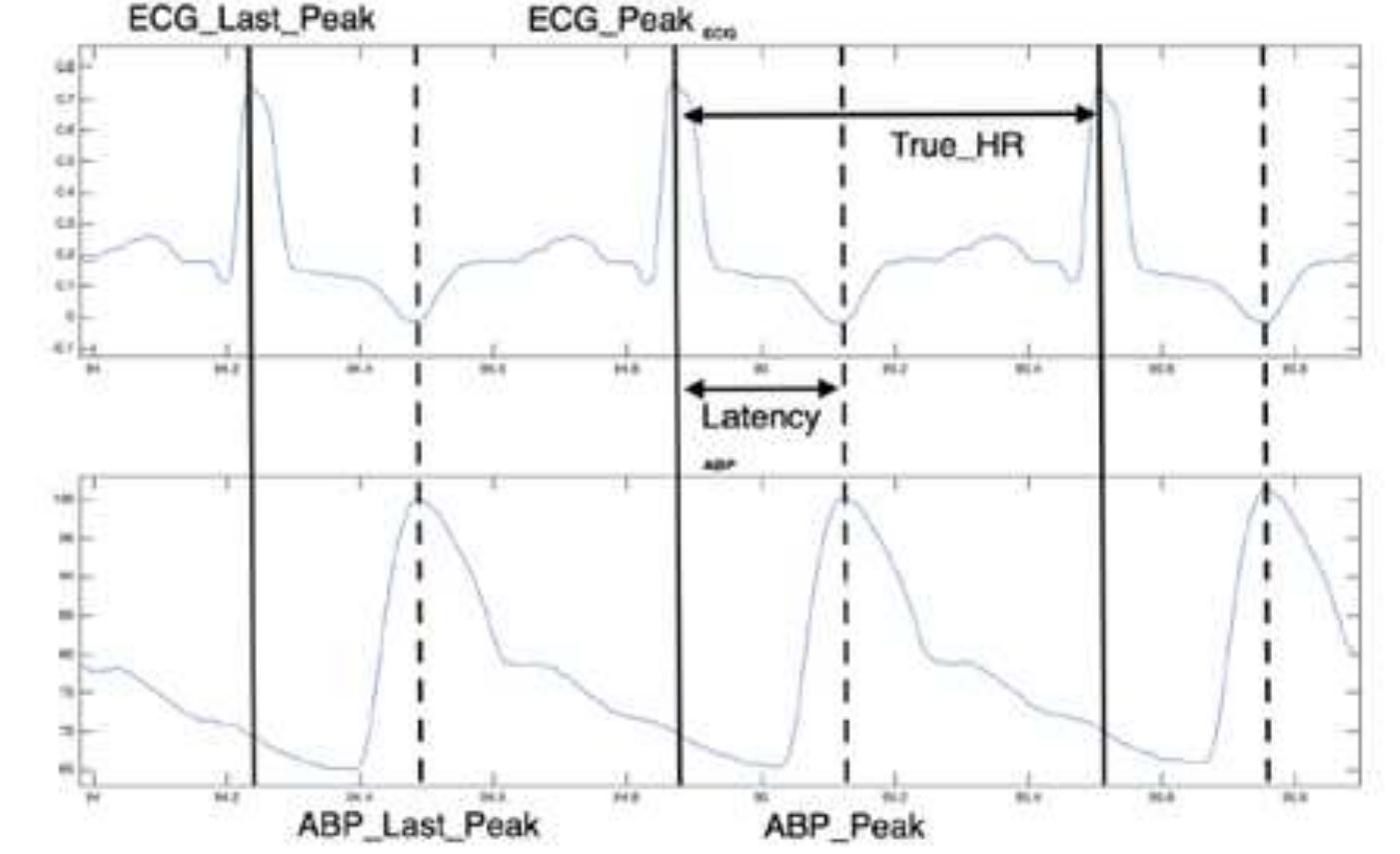 11: circuit diagram for measurement of arterial blood