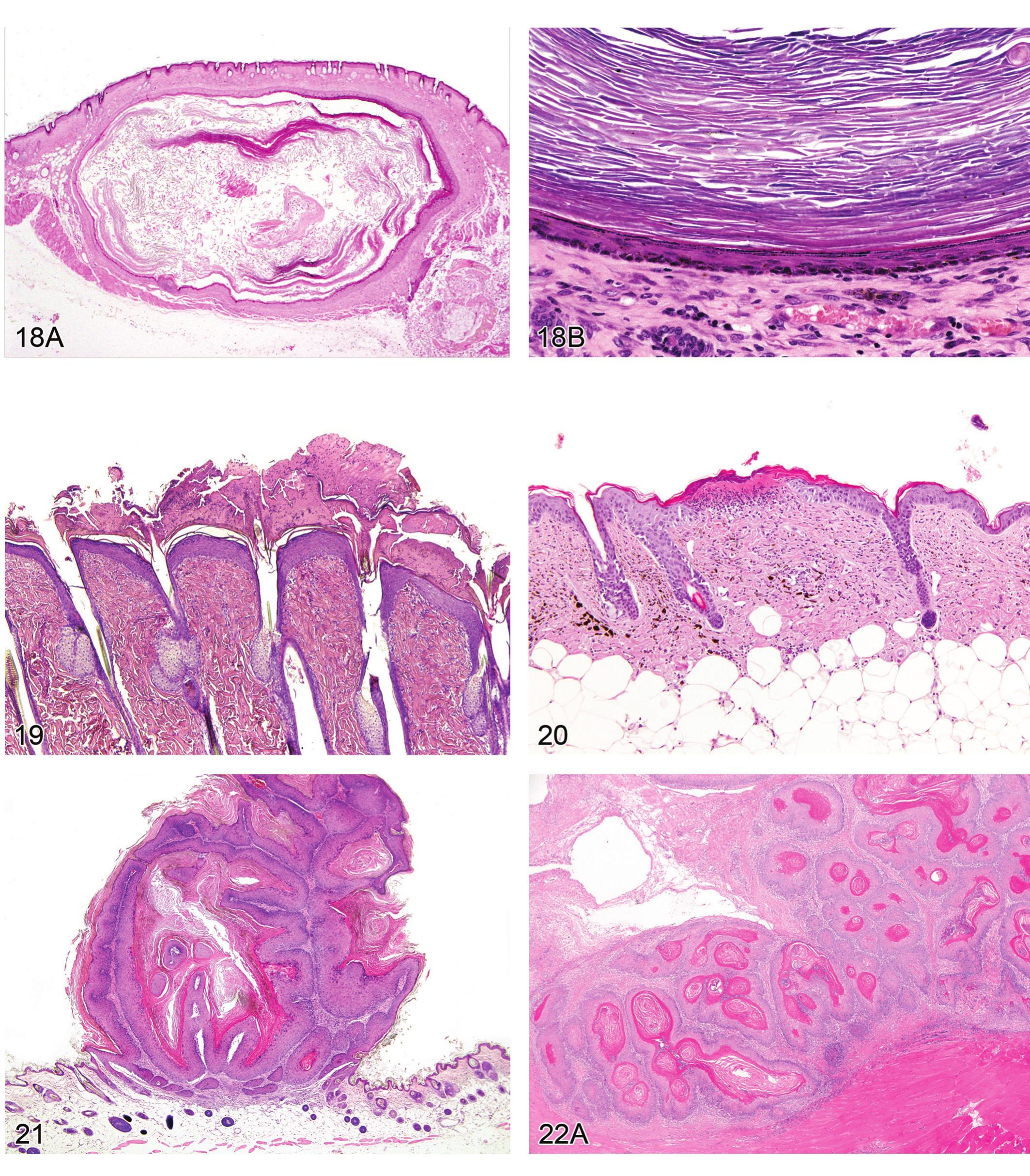 Computer Mouse Cyst (PDF) Proliferative and Non-Proliferative Lesions of the Rat and Mouse ...