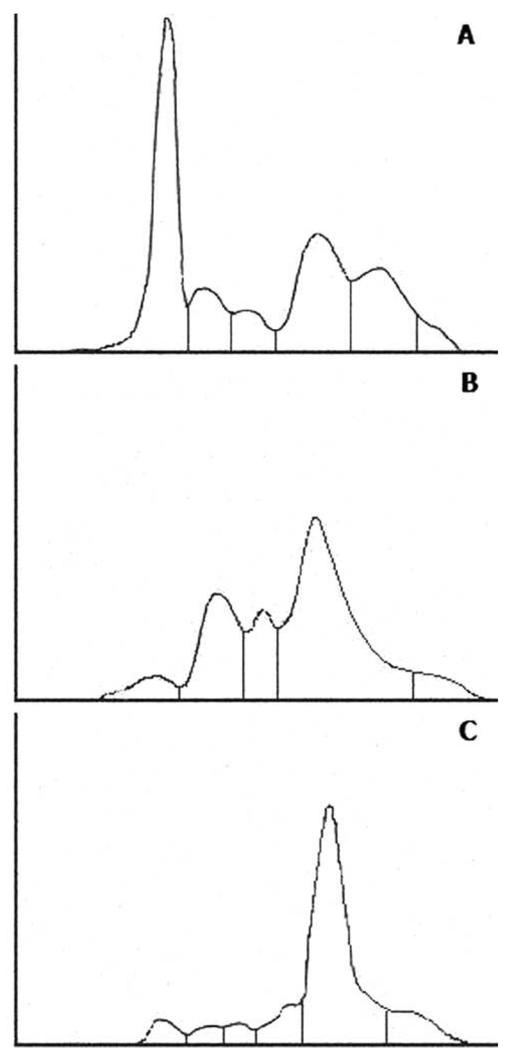 - typical electrophoretic patterns of different types of