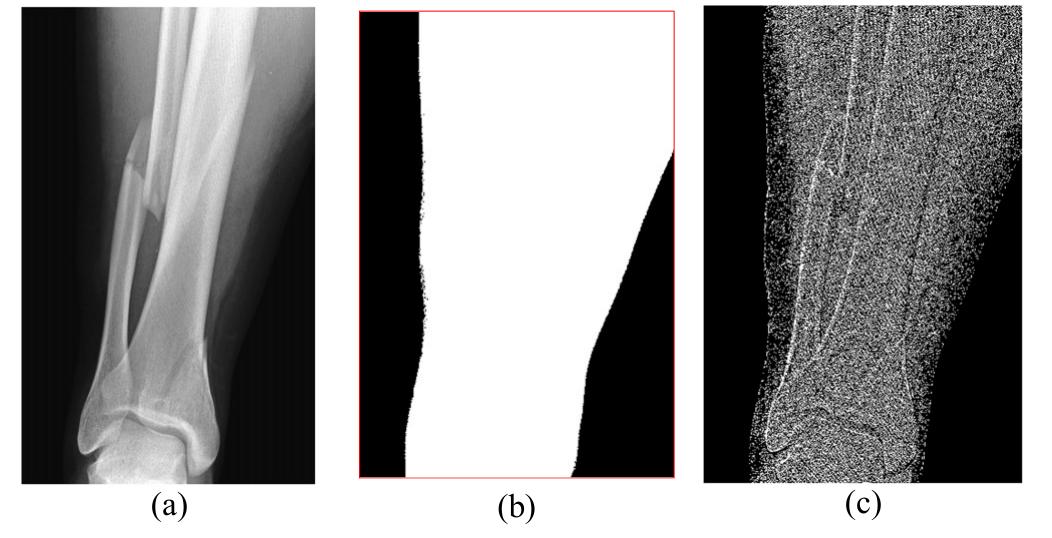 (a) bone x-ray image with uniform background, (b) binary