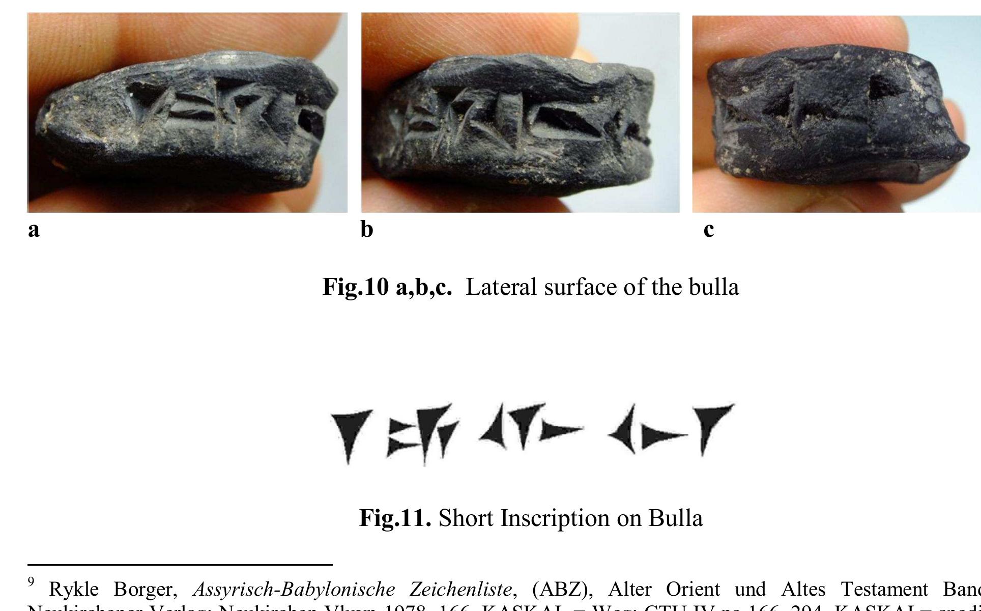 The lateral side of the drop-shaped bulla is 1.3 cm in height, 3.9 cm in length, and 3.2 cm in width. 