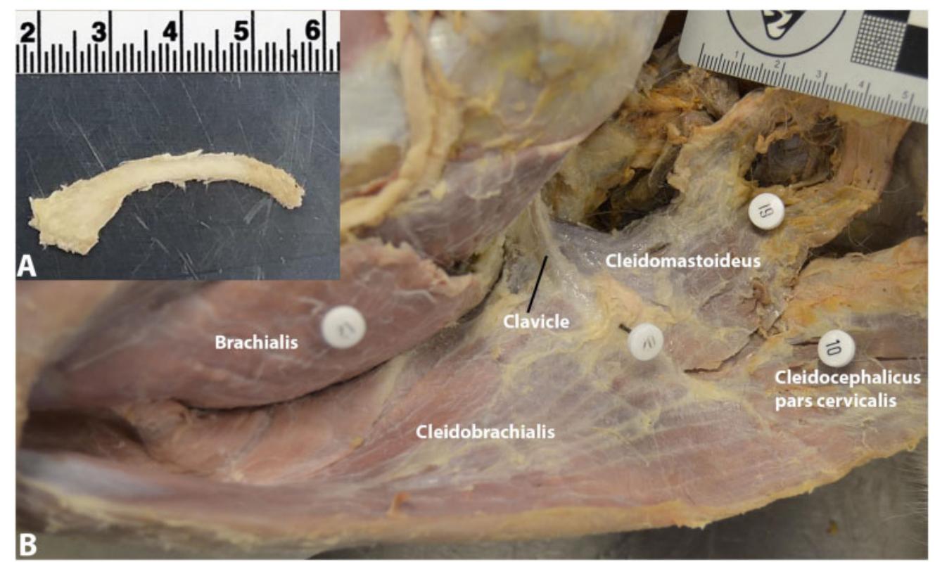 Fig. 6 Photographs of bony clavicle. (A) Unarticulated clavicle. (B) Clavicle in anatomical position on deep surface of m. brachioce- phalicus muscle complex. 