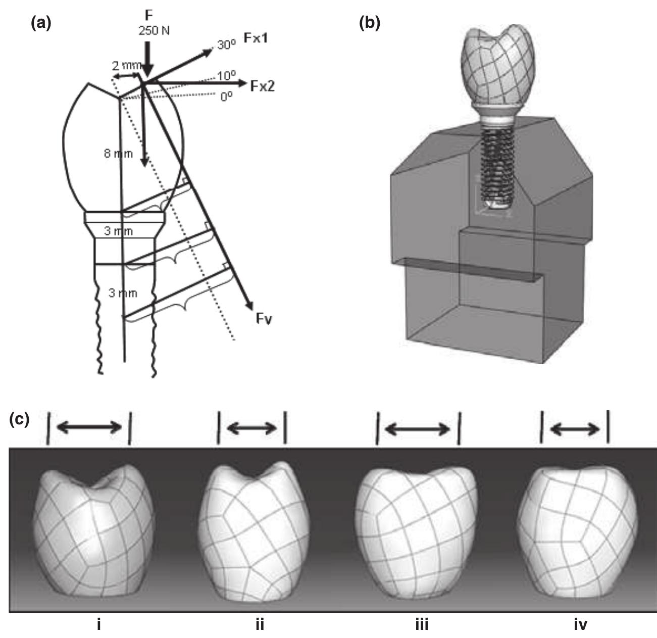 Face Inclination Model (a) diagrammatic representation of crown form to indicate