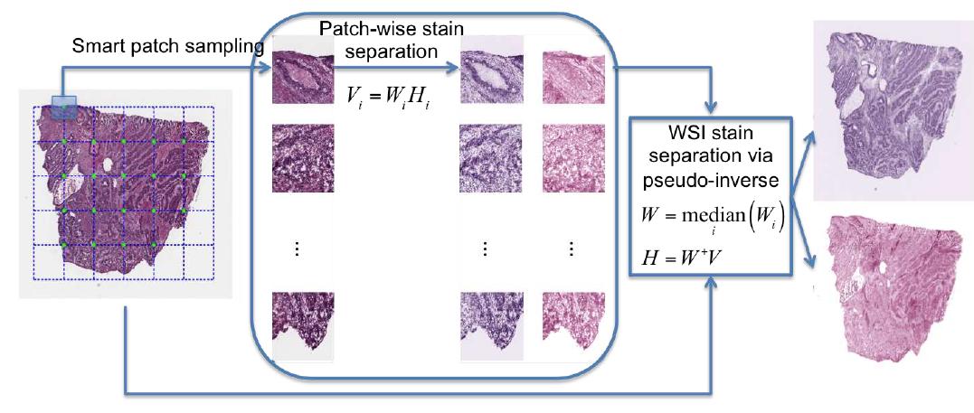 (PDF) Structure-Preserving Color Normalization and Sparse Stain ...