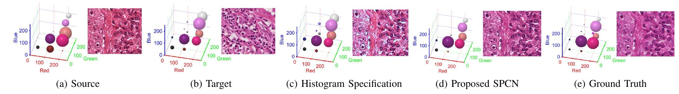 (PDF) Structure-Preserving Color Normalization and Sparse Stain ...
