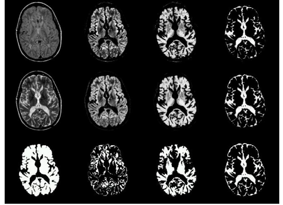 Figure 1 - from MRI Image Segmentation Using Gradient Based