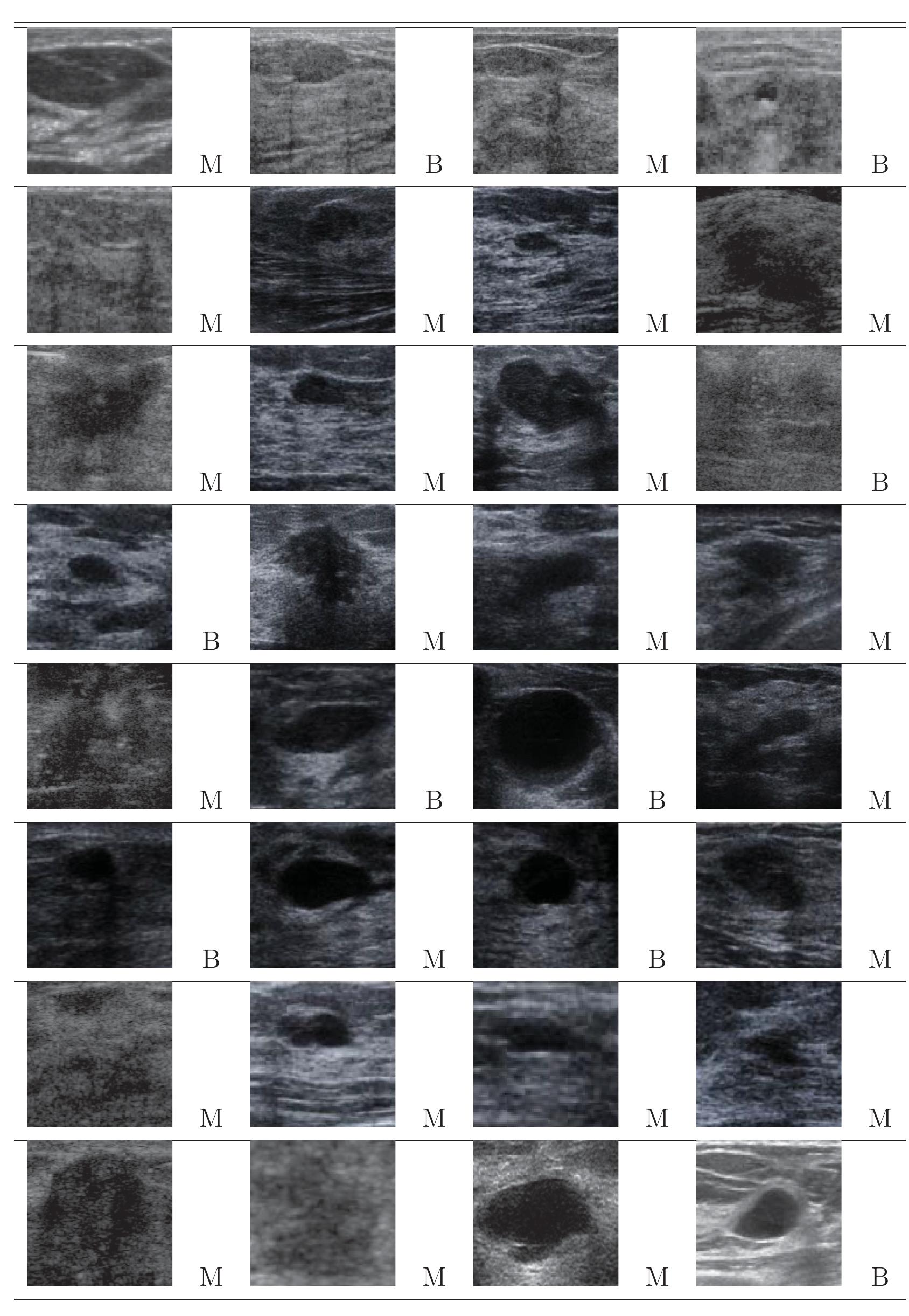 Figure 45 - An automatic system for classification of breast