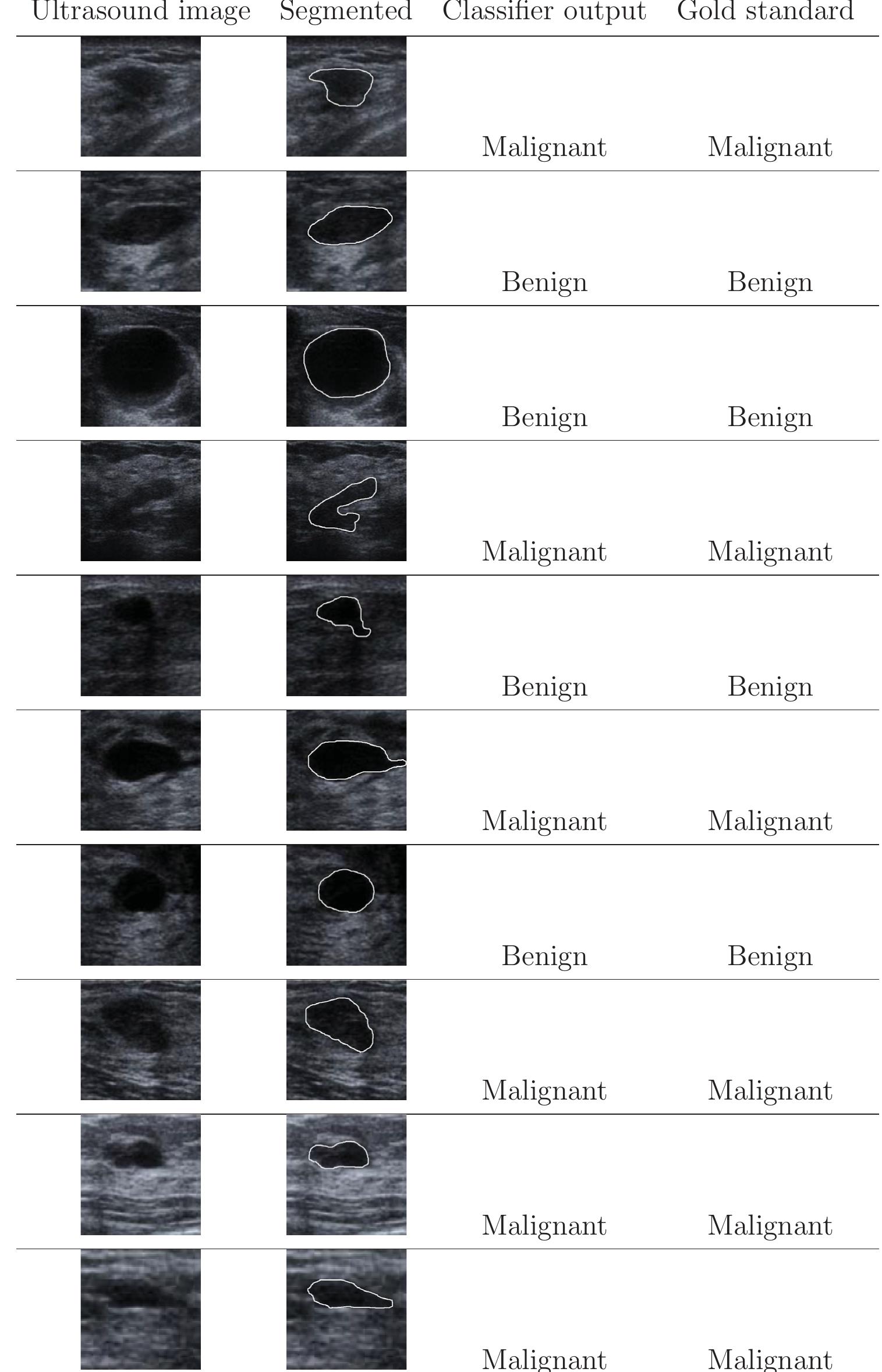 Table 69 - An automatic system for classification of breast