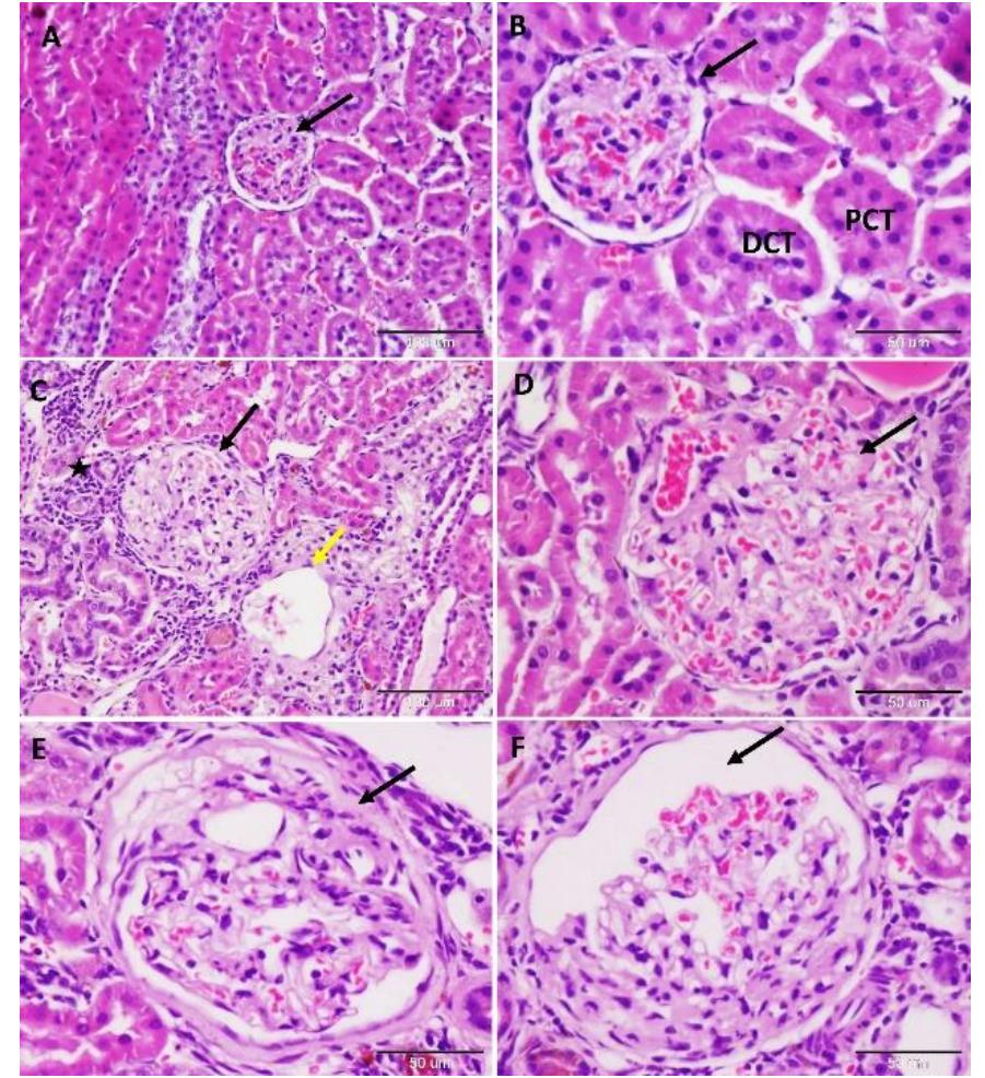 (PDF) Histopathological changes of kidney tissue during aging