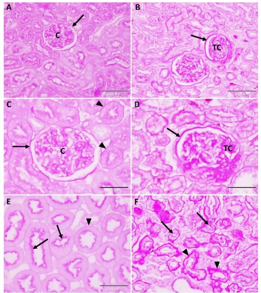 (PDF) Histopathological changes of kidney tissue during aging