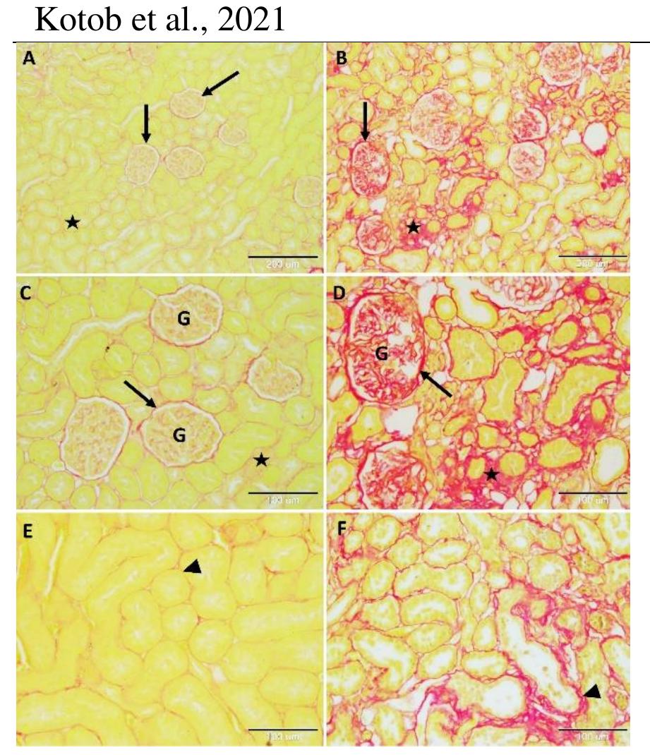 (PDF) Histopathological changes of kidney tissue during aging