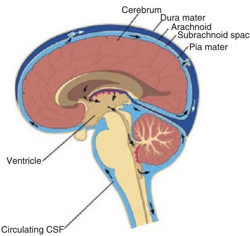 (PDF) Hydrocephalus