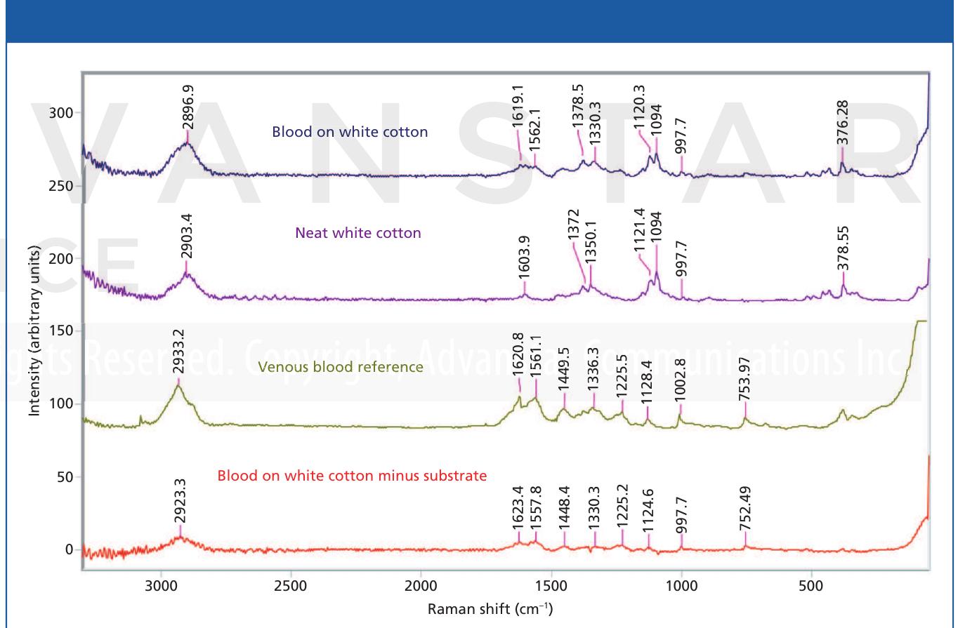 Blood Raman (PDF) The Use of Raman Spectroscopy for the Identification of ...
