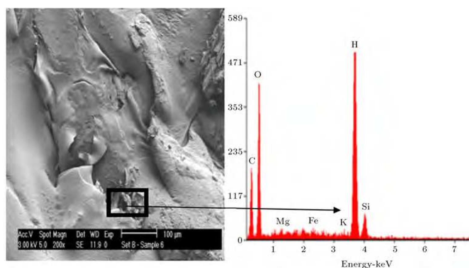 Sem/eds of the microstructure of the composite with 20