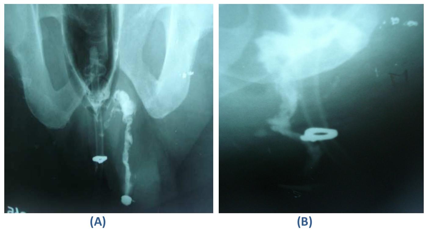 Figure 1 - from Current imaging techniques for evaluation of