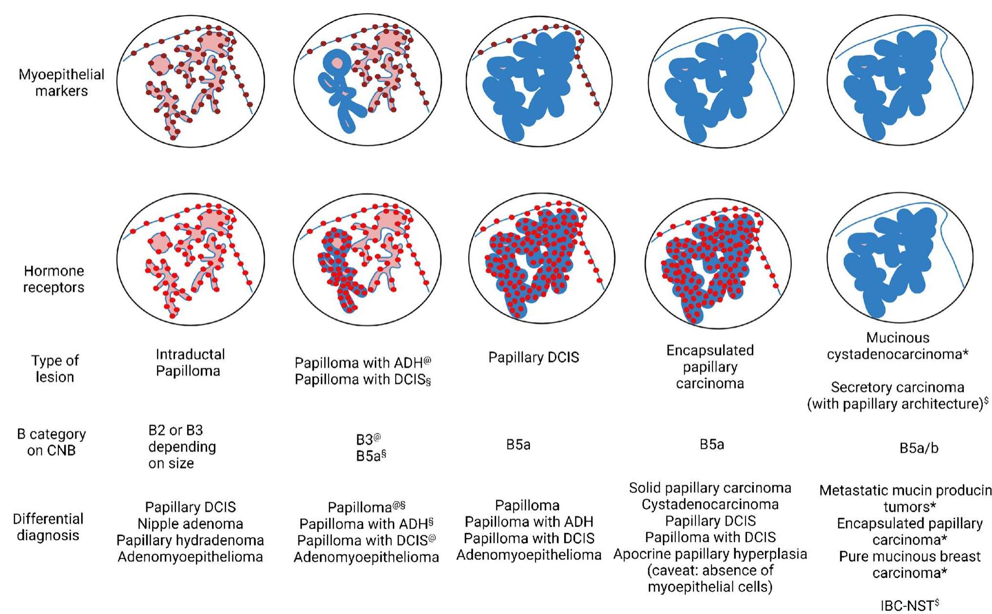 Figure 1 - Papillary lesions of the breast