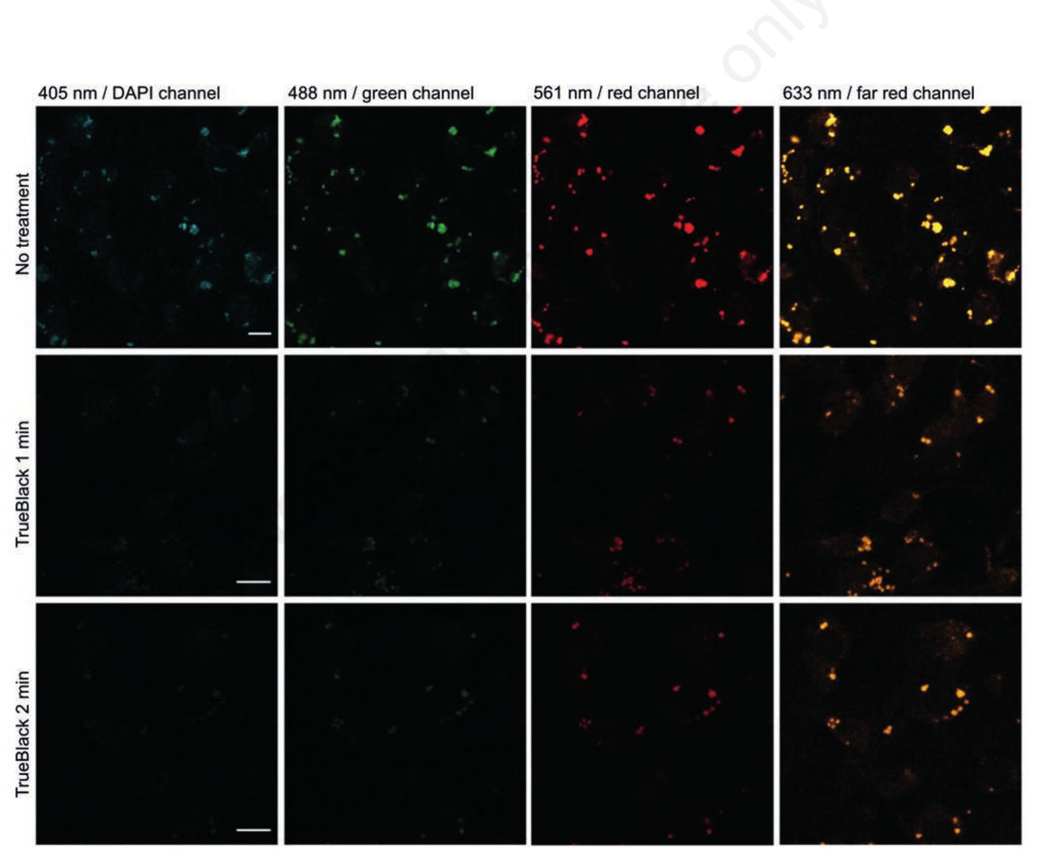 Quench Rbc Autofluorescence (PDF) Autofluorescence in freshly isolated adult human liver sinusoidal ...