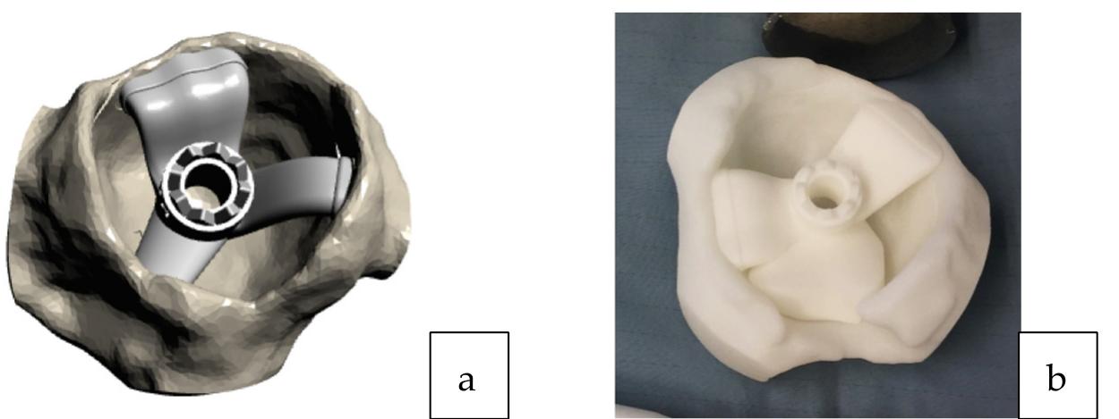 (a) pelvic reference pin and acetabular guide introducer
