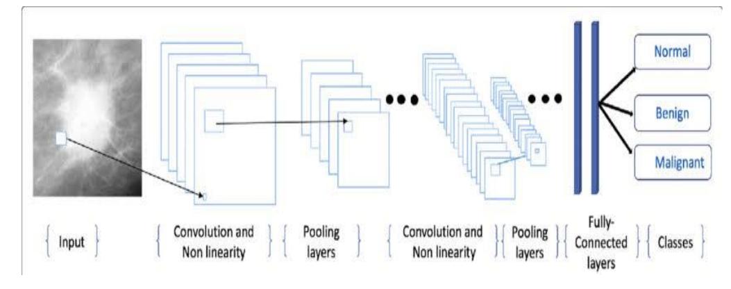 Figure 1 - from Breast Cancer Classification Using Deep