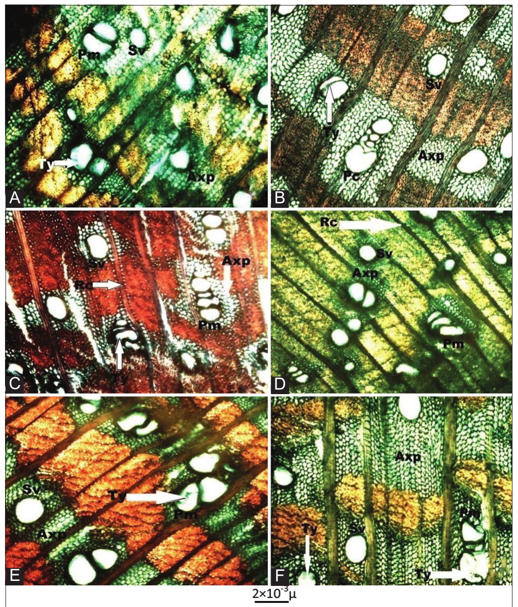 Multiseriate Rays (PDF) Wood Anatomy of Acacia species