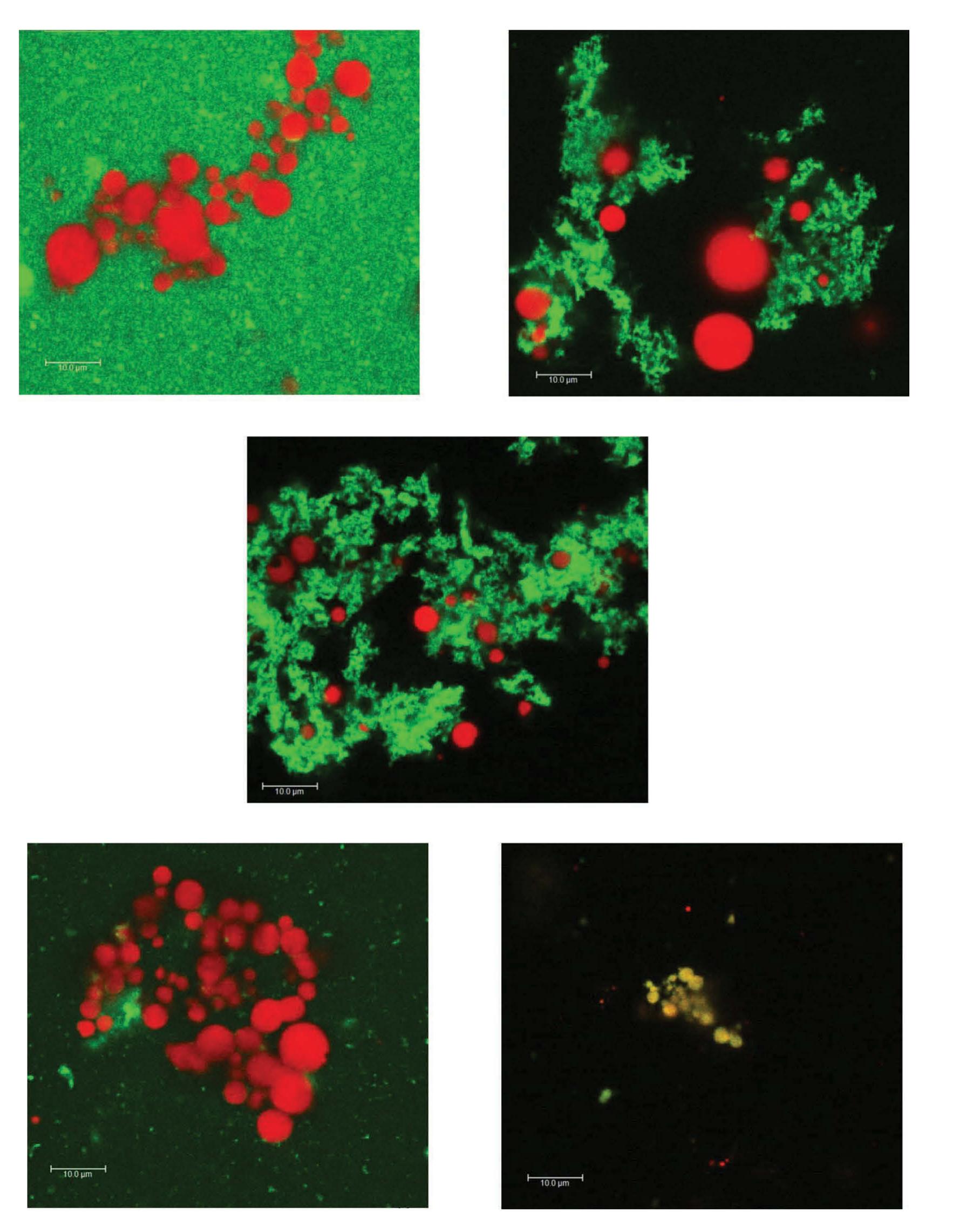 Undigested Milk Image Confocal laser scanning microscopy images of