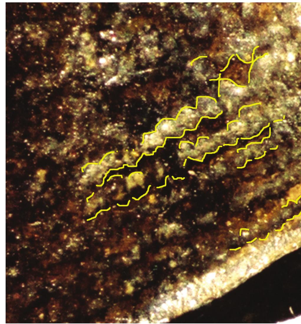 B. bead-like character of epidermal ridges of the