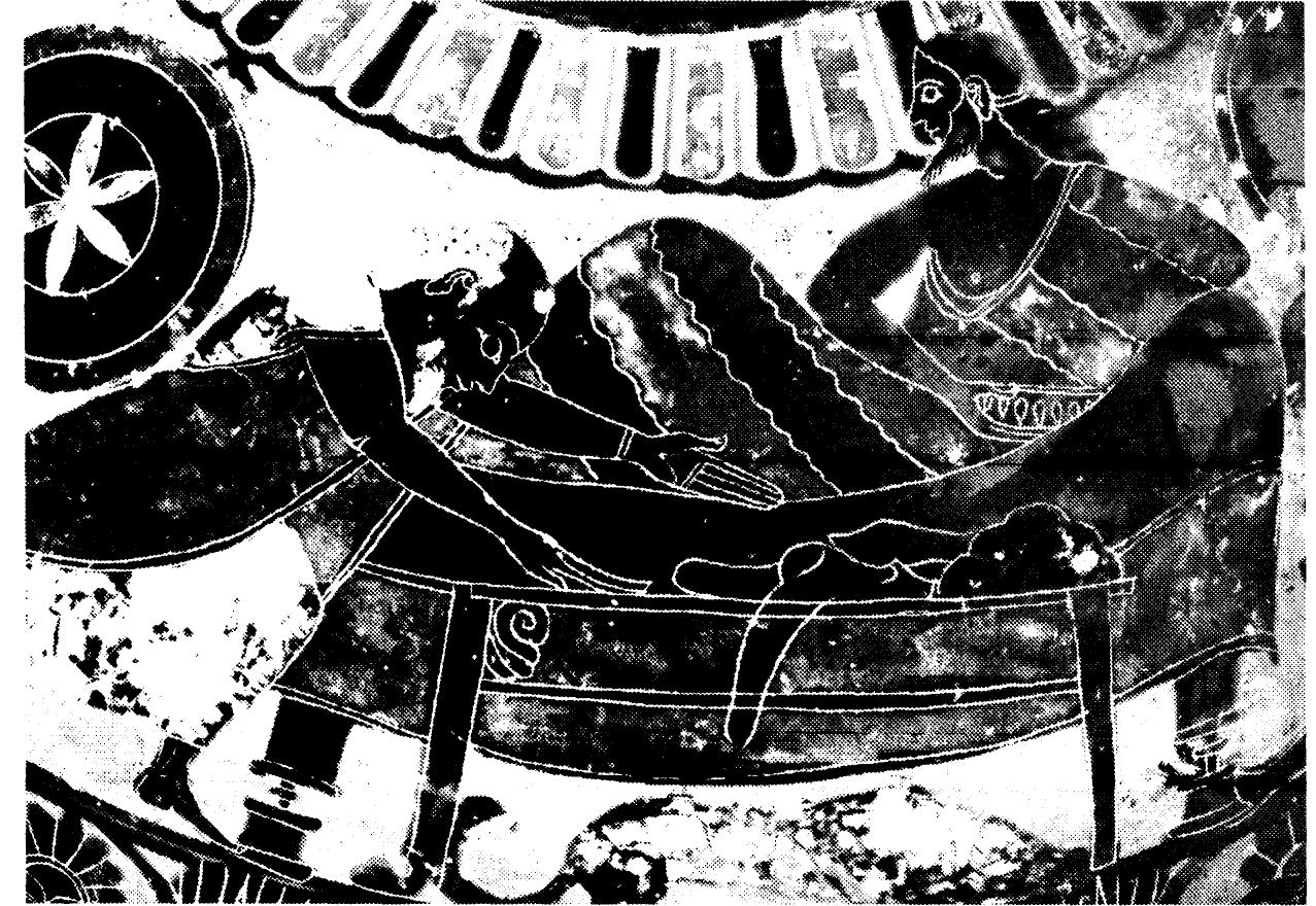 Figure 11: Achilles reclines with lobed phiale in hand. Attic black-figured hydria, 570-560, Ziirich, Archdologisches Institut der Universitat Ziirich. Photograph by Silvia Hertig, Archdologisches Sammlung der Universitat Ziirich. 