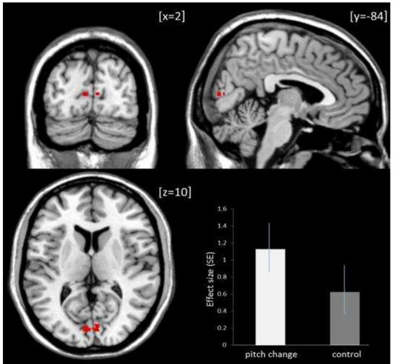 (PDF) The relation of space and musical pitch in the brain