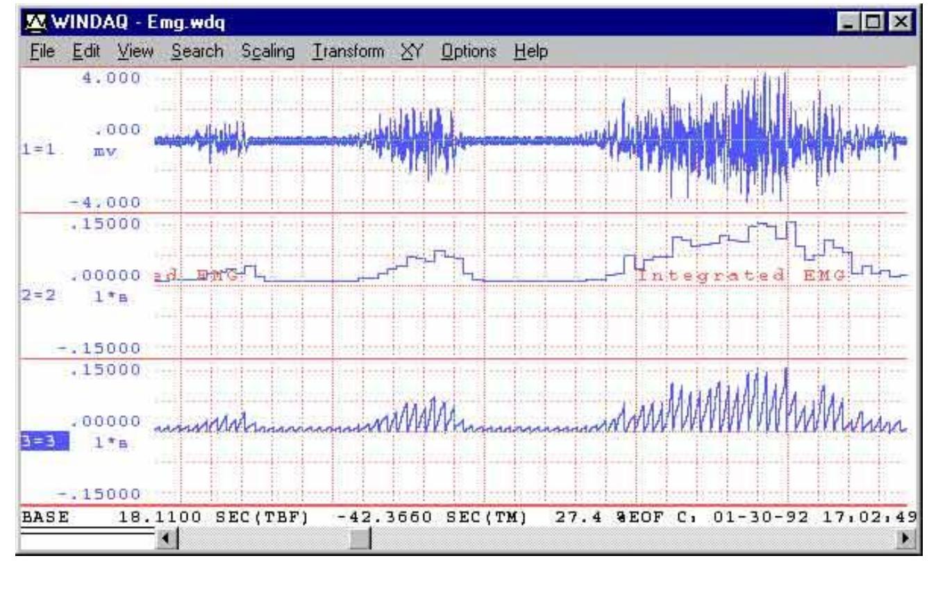 Figure 8 - from Biomechanical evaluation of modified track