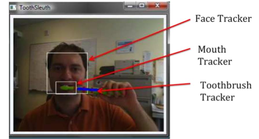 Tracking Toothbrush (PDF) AN INTELLIGENT TOOTHBRUSH: Machines for Smart Brushing