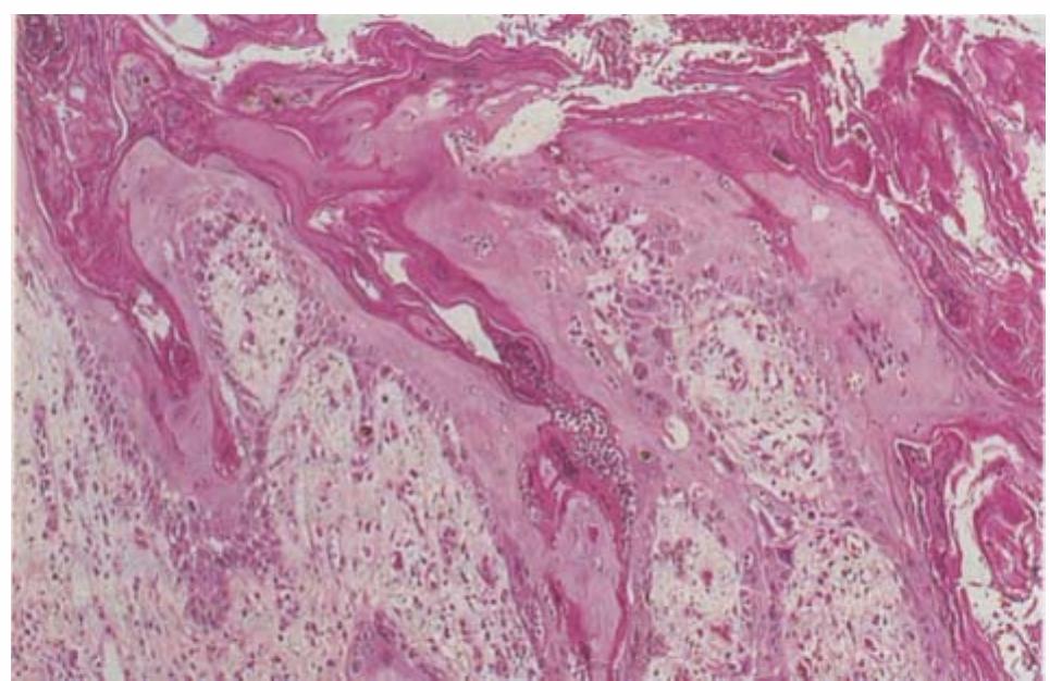 Generalized scaling and alopecia of cat ] at necropsy.