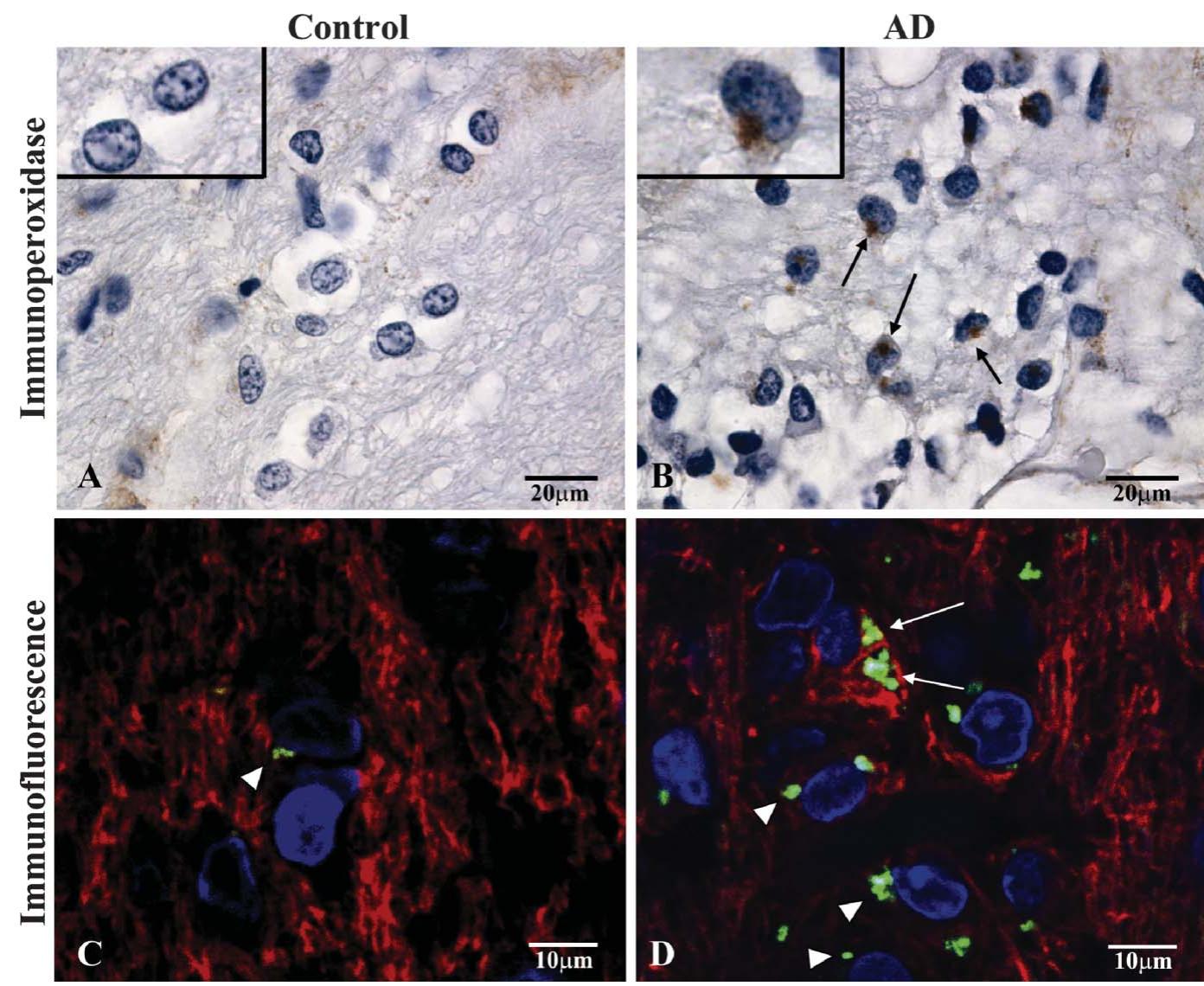 Perinuclear Staining Immunoperoxidase and immunofluorescence labeling of lrp