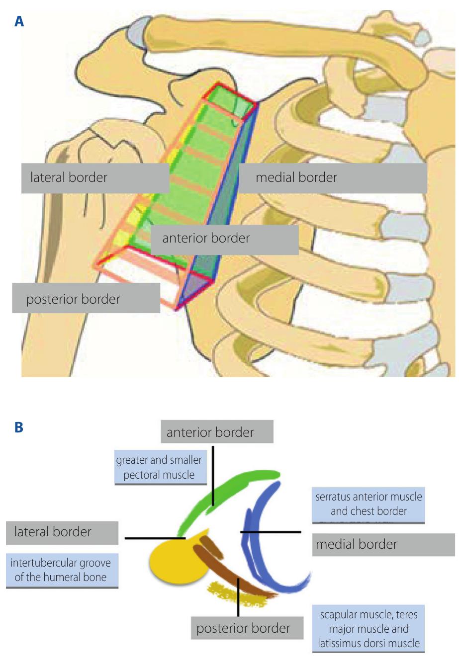 Transverse Axillary Incision Sagittal cross section of the breast