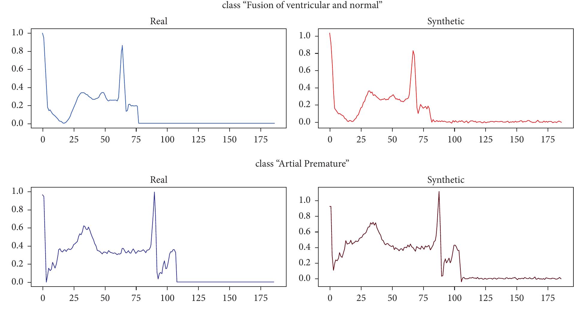 (PDF) Classification of Arrhythmia in Heartbeat Detection Using Deep ...